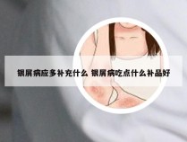 银屑病应多补充什么 银屑病吃点什么补品好