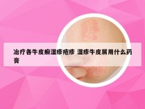 冶疗各牛皮癣湿疹疮疹 湿疹牛皮屑用什么药膏