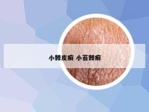 小棘皮癣 小苔棘癣