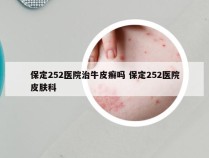 保定252医院治牛皮癣吗 保定252医院皮肤科