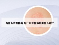 为什么会有体癣 为什么会有体癣用什么药好