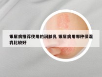 银屑病推荐使用的润肤乳 银屑病用哪种保湿乳比较好