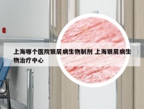 上海哪个医院银屑病生物制剂 上海银屑病生物治疗中心