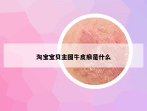 淘宝宝贝主图牛皮癣是什么