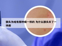 额头为啥有那种癣一样的 为什么额头长了一块癣