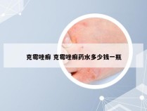 克霉唑癣 克霉唑癣药水多少钱一瓶