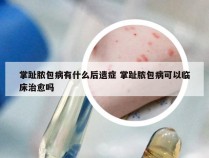 掌趾脓包病有什么后遗症 掌趾脓包病可以临床治愈吗