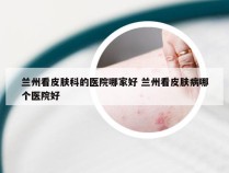 兰州看皮肤科的医院哪家好 兰州看皮肤病哪个医院好