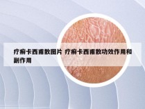 疗癣卡西甫散图片 疗癣卡西甫散功效作用和副作用