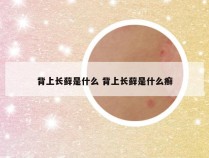 背上长藓是什么 背上长藓是什么癣