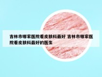 吉林市哪家医院看皮肤科最好 吉林市哪家医院看皮肤科最好的医生