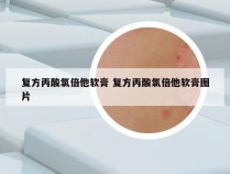 复方丙酸氯倍他软膏 复方丙酸氯倍他软膏图片