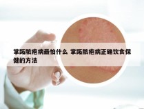 掌跖脓疱病最怕什么 掌跖脓疱病正确饮食保健的方法