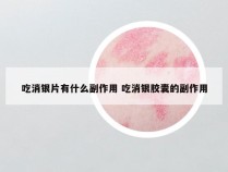 吃消银片有什么副作用 吃消银胶囊的副作用