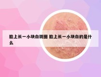 脸上长一小块白斑图 脸上长一小块白的是什么