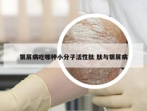 银屑病吃哪种小分子活性肽 肽与银屑病