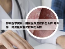 郑州医学院第一附属医院皮肤科怎么样 郑州第一附属医院看皮肤病怎么样