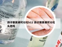 孩子银屑病可以吃b12 孩子银屑病可以吃头孢吗