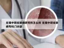 无锡中研皮肤病研究院怎么样 无锡中研皮肤病专科门诊部