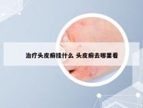 治疗头皮癣挂什么 头皮癣去哪里看