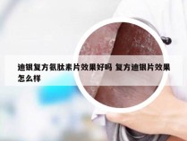 迪银复方氨肽素片效果好吗 复方迪银片效果怎么样