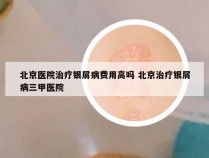 北京医院治疗银屑病费用高吗 北京治疗银屑病三甲医院