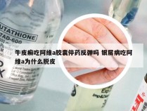 牛皮癣吃阿维a胶囊停药反弹吗 银屑病吃阿维a为什么脱皮