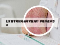 北京看掌跖脓疱病哪家医院好 掌跖脓疱病咨询