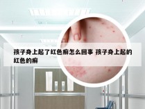 孩子身上起了红色癣怎么回事 孩子身上起的红色的癣