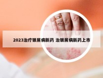 2023治疗银屑病新药 治银屑病新药上市