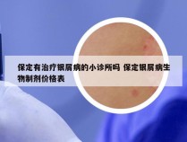 保定有治疗银屑病的小诊所吗 保定银屑病生物制剂价格表