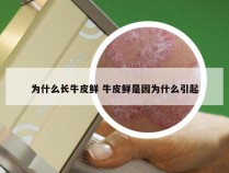 为什么长牛皮鲜 牛皮鲜是因为什么引起