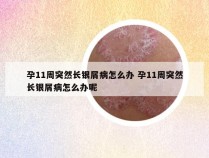 孕11周突然长银屑病怎么办 孕11周突然长银屑病怎么办呢