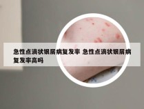 急性点滴状银屑病复发率 急性点滴状银屑病复发率高吗