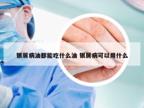 银屑病油都能吃什么油 银屑病可以用什么