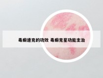 毒癣速克的功效 毒癣克星功能主治