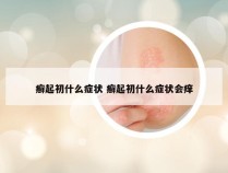 癣起初什么症状 癣起初什么症状会痒