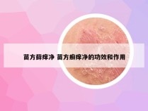 苗方藓痒净 苗方癣痒净的功效和作用