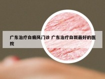 广东治疗白癜风门诊 广东治疗白斑最好的医院