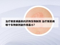 治疗银屑病最新的药物生物制剂 治疗银屑病哪个生物制剂副作用最小?