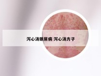 泻心汤银屑病 泻心汤方子