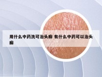 用什么中药洗可治头癣 有什么中药可以治头癣