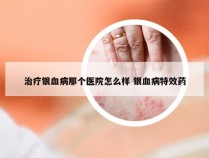 治疗银血病那个医院怎么样 银血病特效药