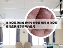 北京空军总院皮肤科专家坐诊时间 北京空军总院皮肤科专家预约挂号