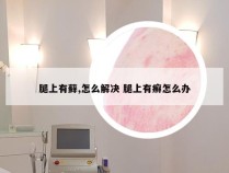 腿上有藓,怎么解决 腿上有癣怎么办