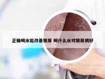 正确喝水能改善银屑 喝什么水对银屑病好