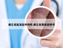 癣立克能涂在外阴吗 癣立克使用说明书