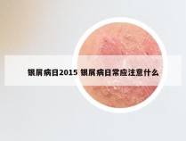 银屑病日2015 银屑病日常应注意什么