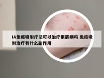 IA免疫吸附疗法可以治疗银屑病吗 免疫吸附治疗有什么副作用