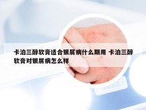 卡泊三醇软膏适合银屑病什么期用 卡泊三醇软膏对银屑病怎么样